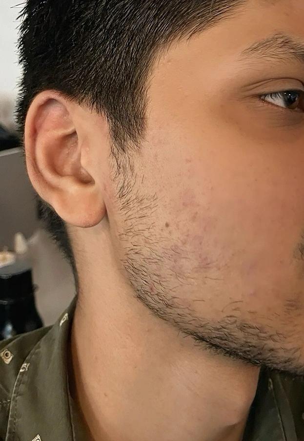 After using Clear Ritual