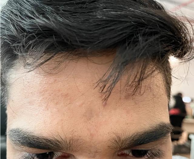 After using Clear Ritual