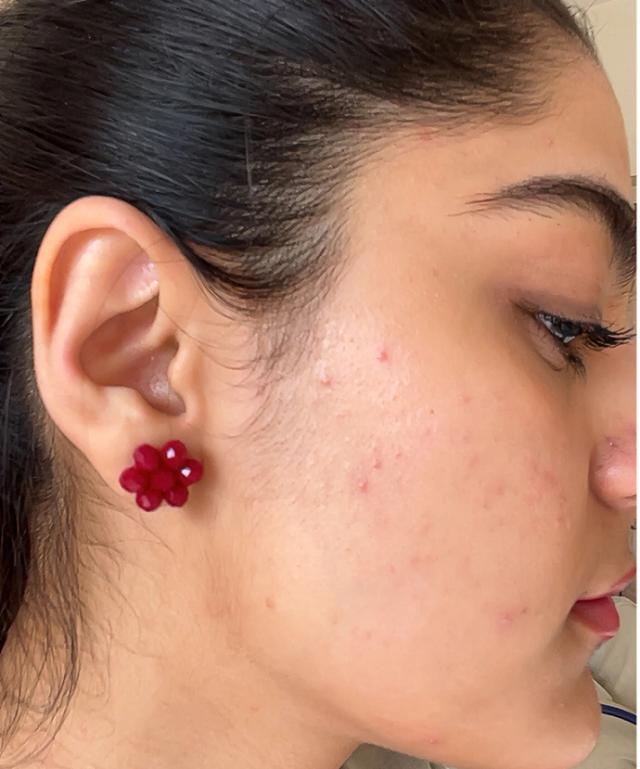 Before using Clear Ritual