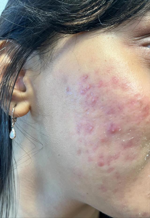Before using Clear Ritual