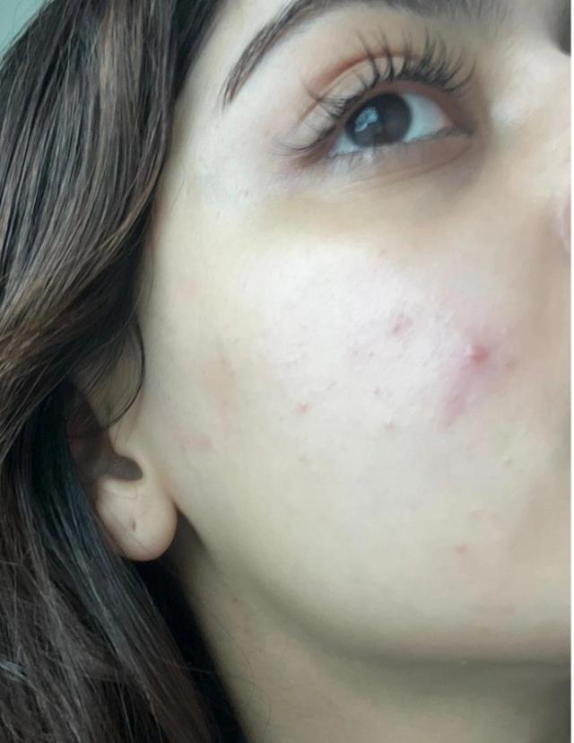 Before using Clear Ritual