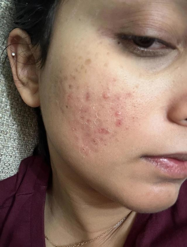Before using Clear Ritual