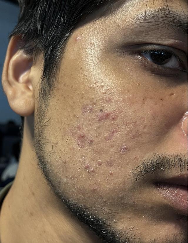 Before using Clear Ritual