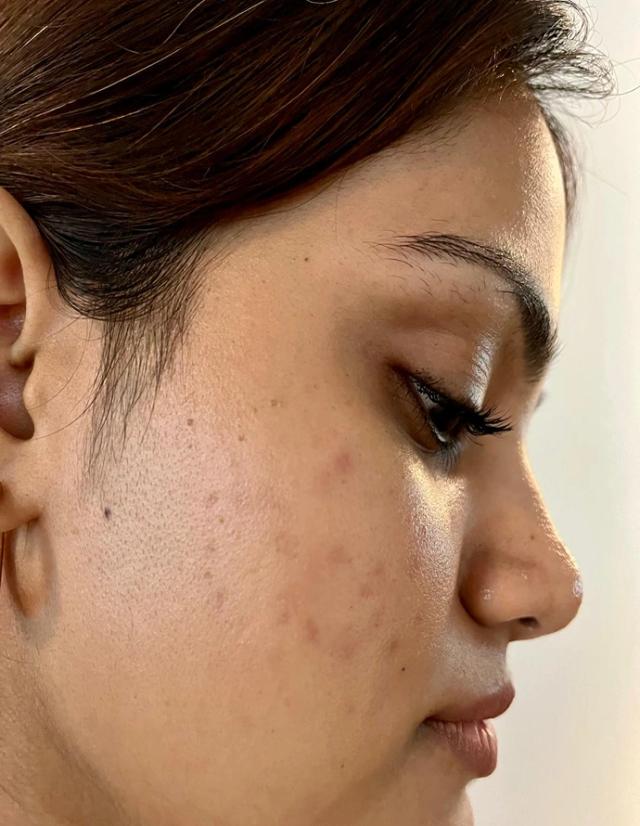 Before using Clear Ritual