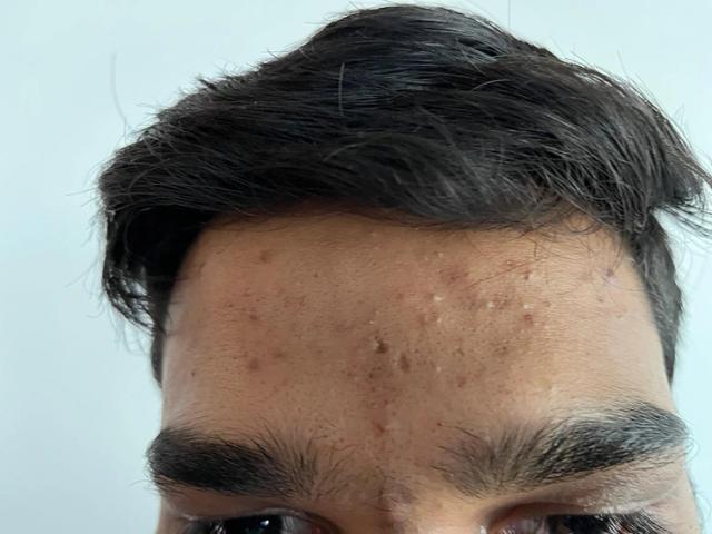 Before using Clear Ritual