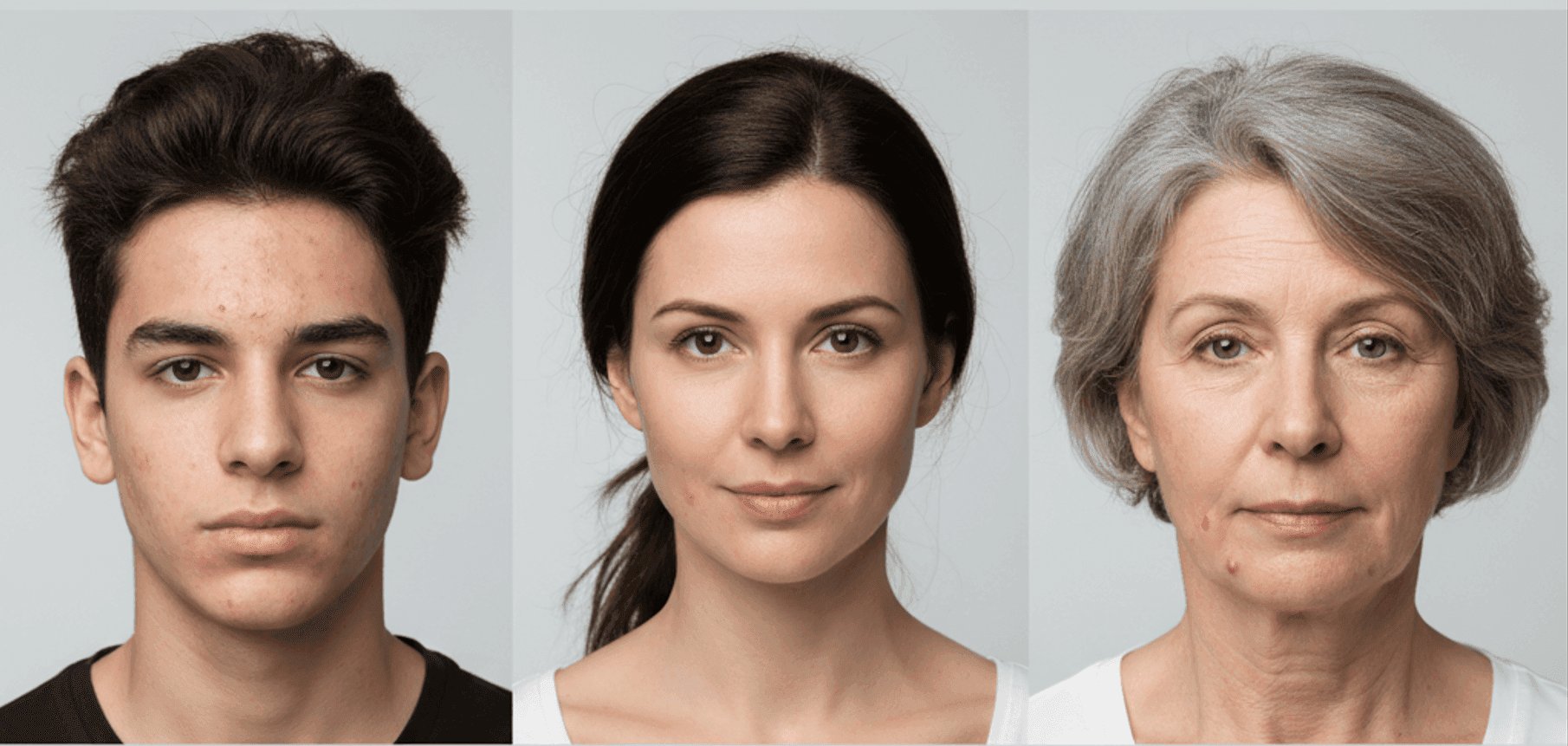 Acne causes across different age groups