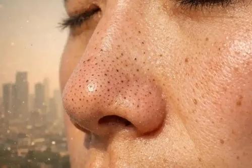 Climate & Blackheads: Why Your City’s Weather Affects Your Skin