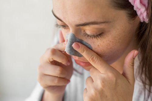 How to Prevent Blackheads Permanently: Long-Term Strategies