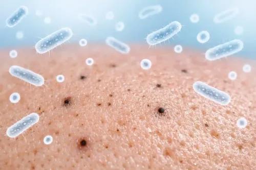 Microbiome & Blackheads: How Skin Bacteria Influence Pore Health