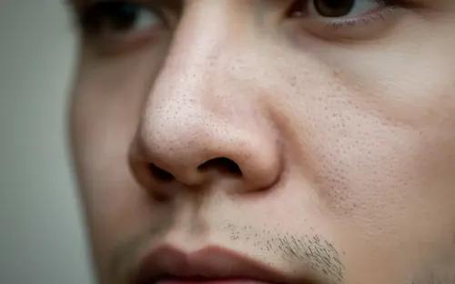 Blackheads on Nose: Why They’re So Stubborn & How to Treat Them