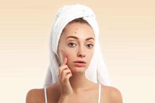 The Science of Sebum: How Oil Balance Impacts Blackheads