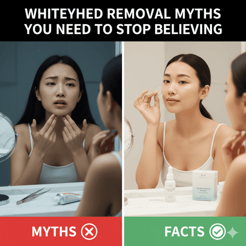 Whitehead Removal Myths You Need to Stop Believing